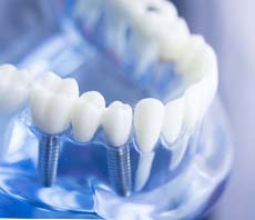  Best Dental Clinic in Sonipat